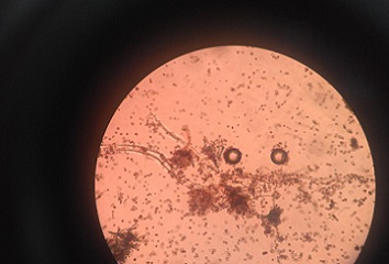 estudia ingenier�a bioqu�mica