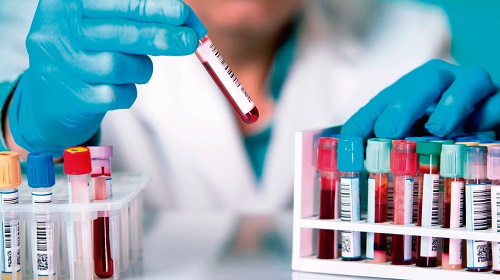 requisitos para estudiar la especialidad
de hematología requisitos para estudiar la especialidad de hematología