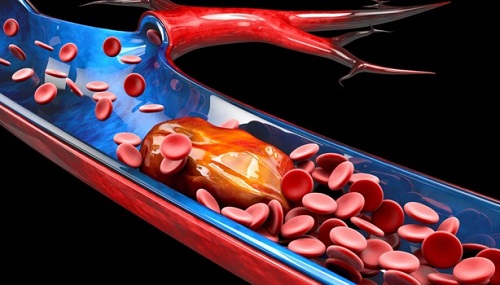 enfermedades que trata la hematología enfermedades que trata la hematología